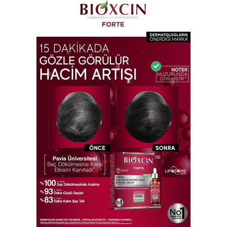 Bioxcin Forte Anti-Hair Loss Serum